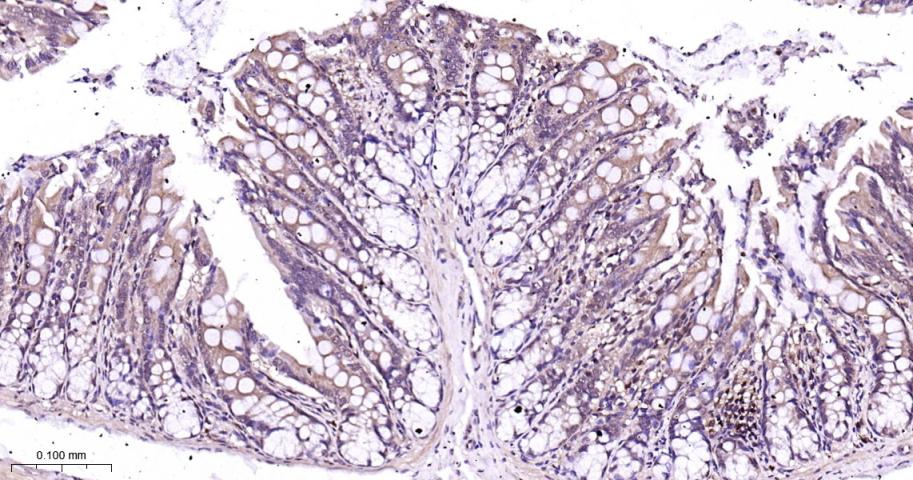 p38 MAPK重组兔单抗