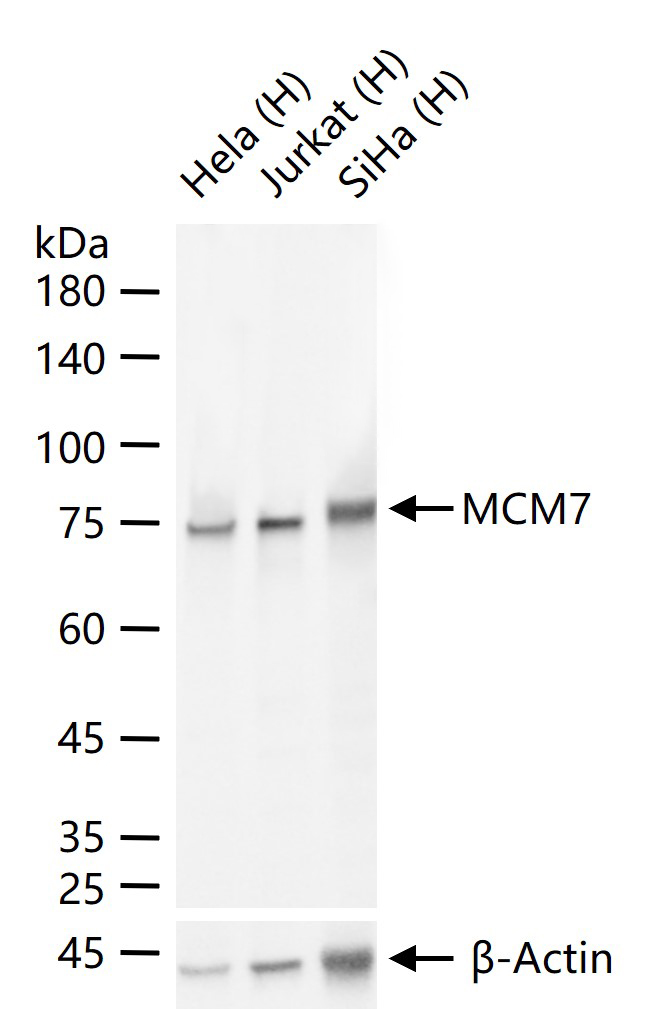 微小染色体维持缺陷蛋白7重组兔单克隆抗体