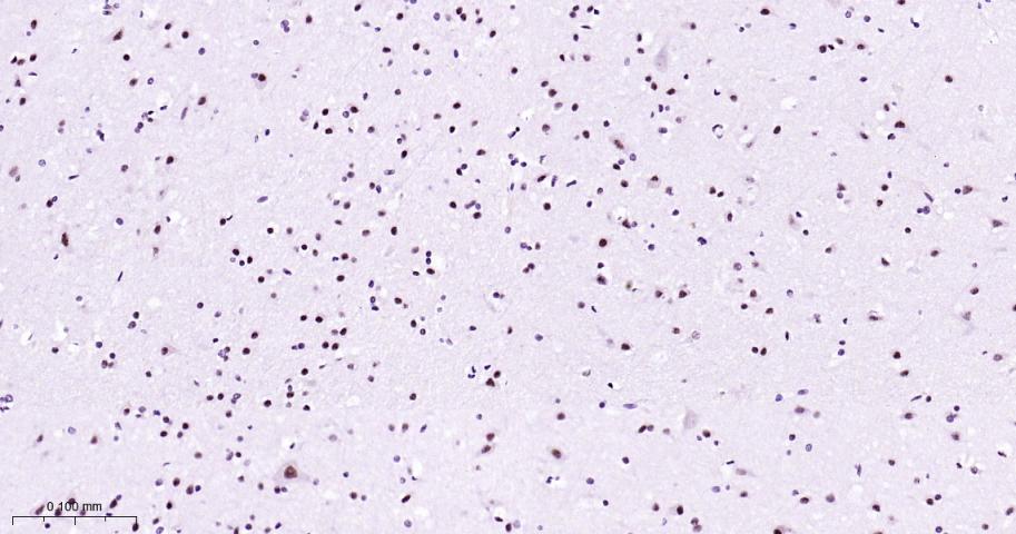 丝裂原活化蛋白激酶p38α重组兔单抗