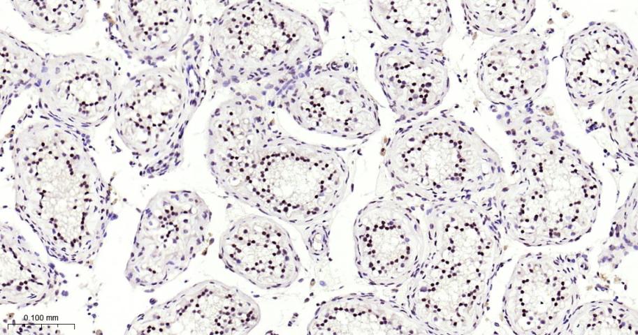 甲基转移酶样蛋白3重组兔单抗