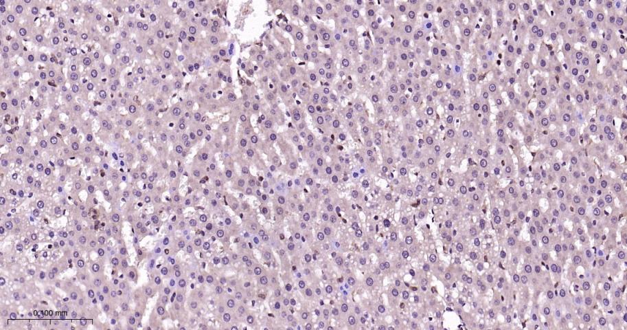 p38 MAPK重组兔单抗