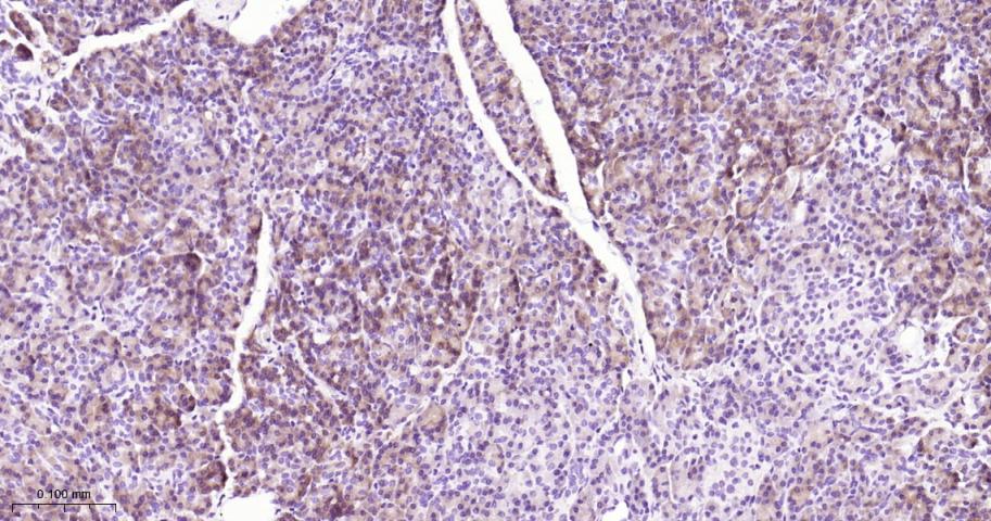 丝氨酸羧甲半胱氨酸合成酶重组兔单抗