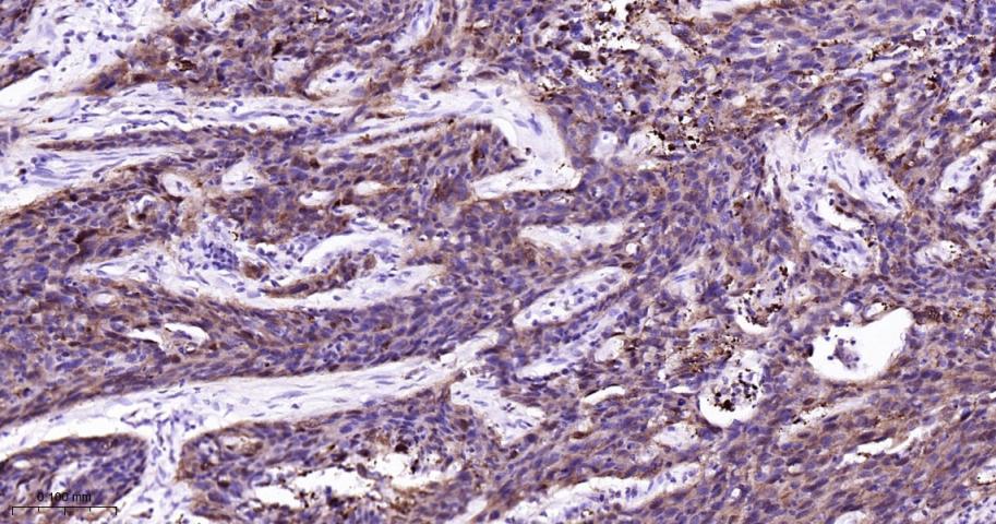 丝裂原活化蛋白激酶p38α重组兔单抗
