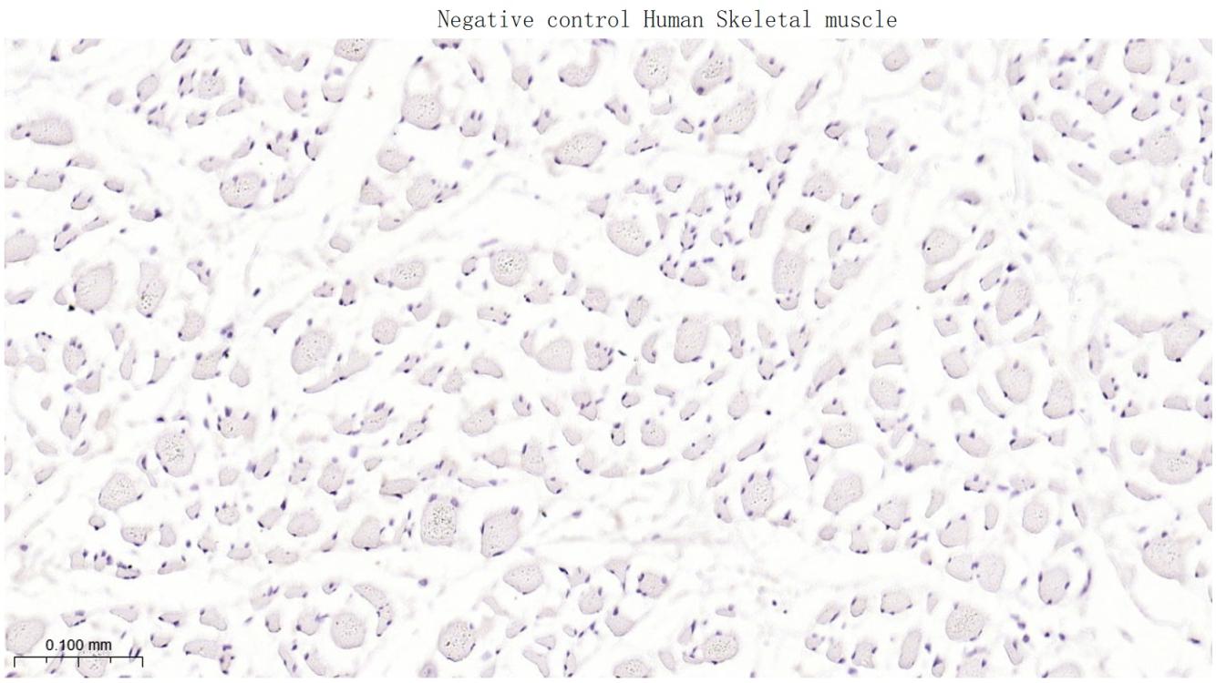 丝氨酸羧甲半胱氨酸合成酶重组兔单抗