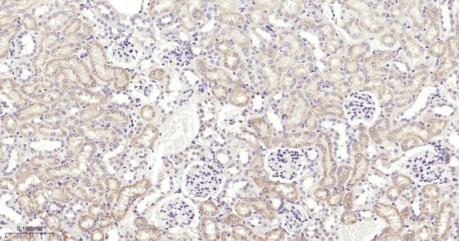 Fas死亡结构域相关蛋白重组兔单抗-bsm-61661R