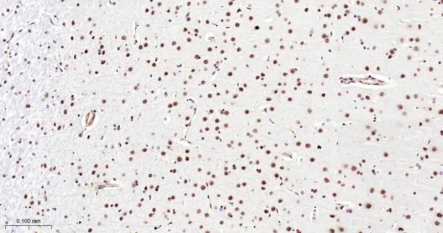 甲基转移酶样蛋白3重组兔单抗