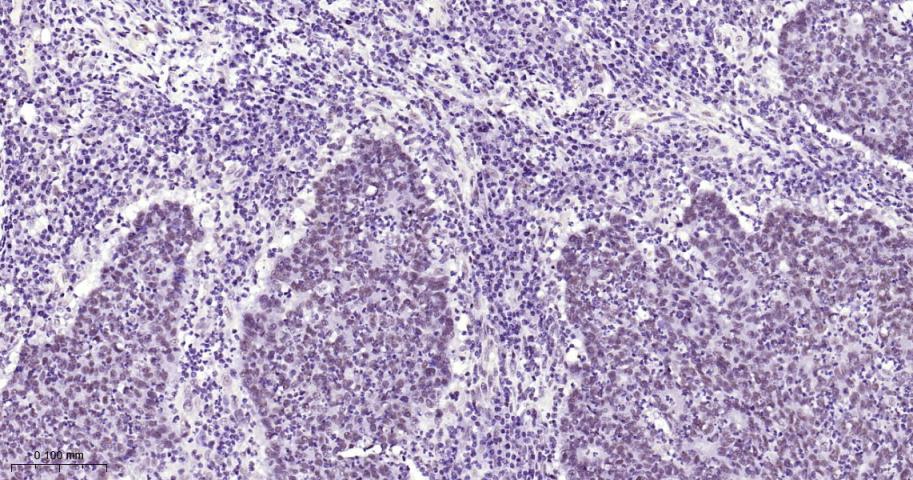 甲基转移酶样蛋白3重组兔单抗