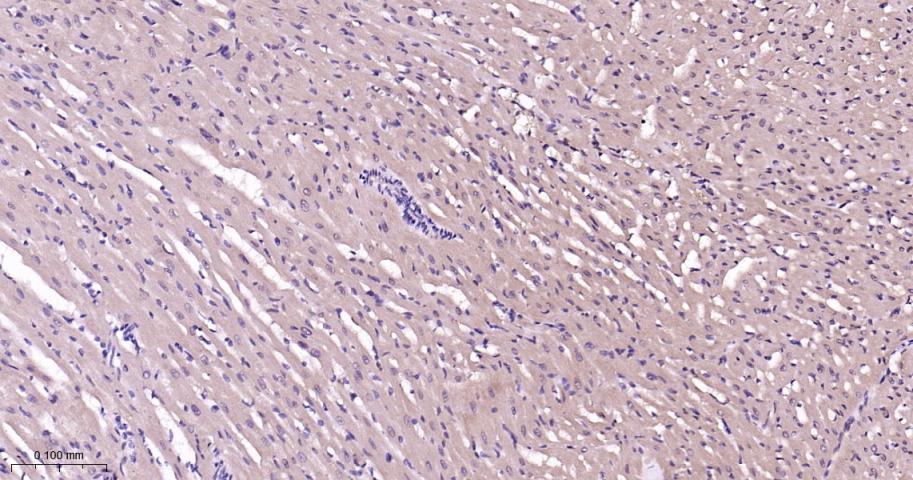 p38 MAPK重组兔单抗