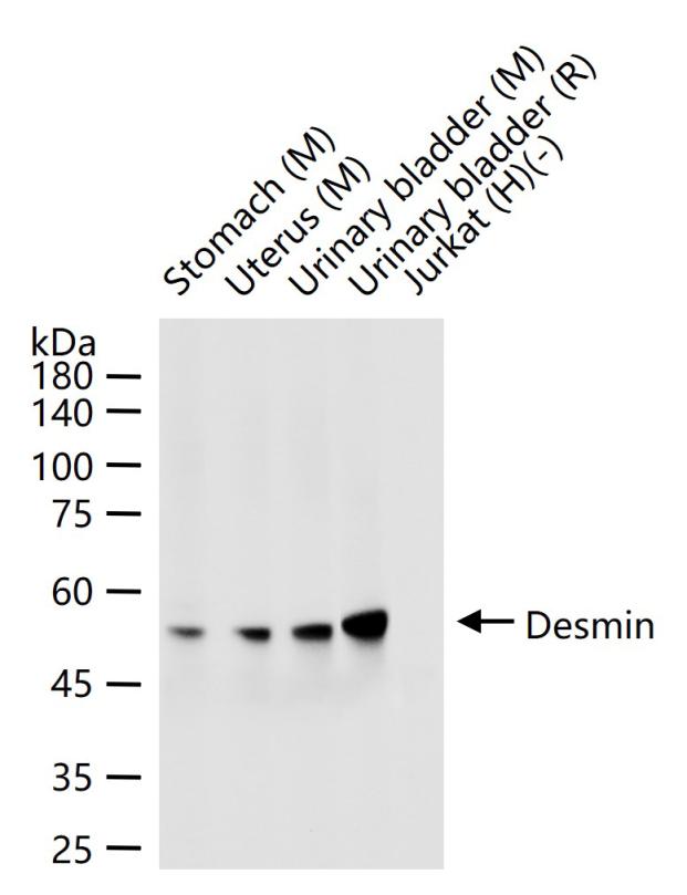 结蛋白重组兔单抗