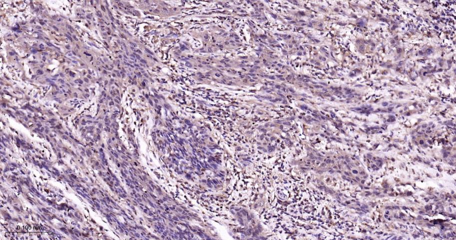 p38 MAPK重组兔单抗