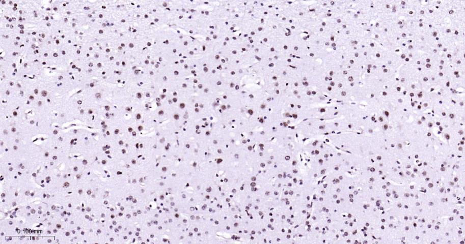 丝裂原活化蛋白激酶p38α重组兔单抗