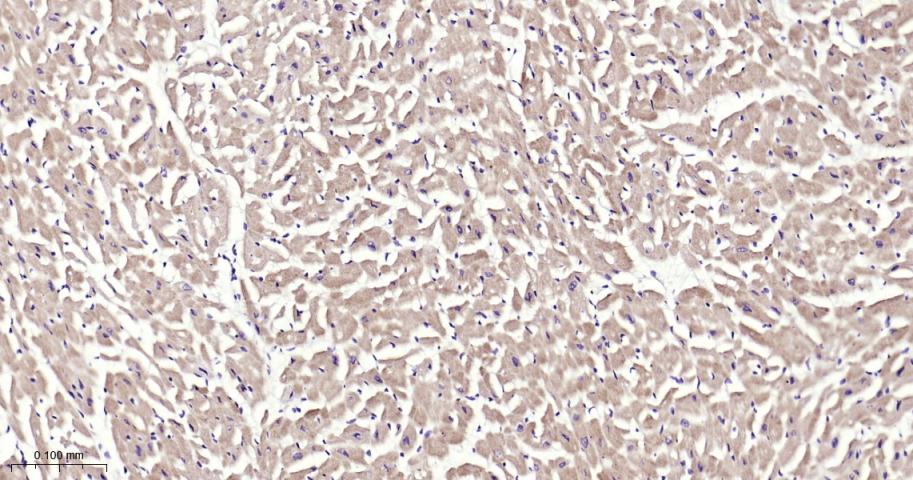 自噬相关蛋白4C重组兔单抗-bsm-61516R