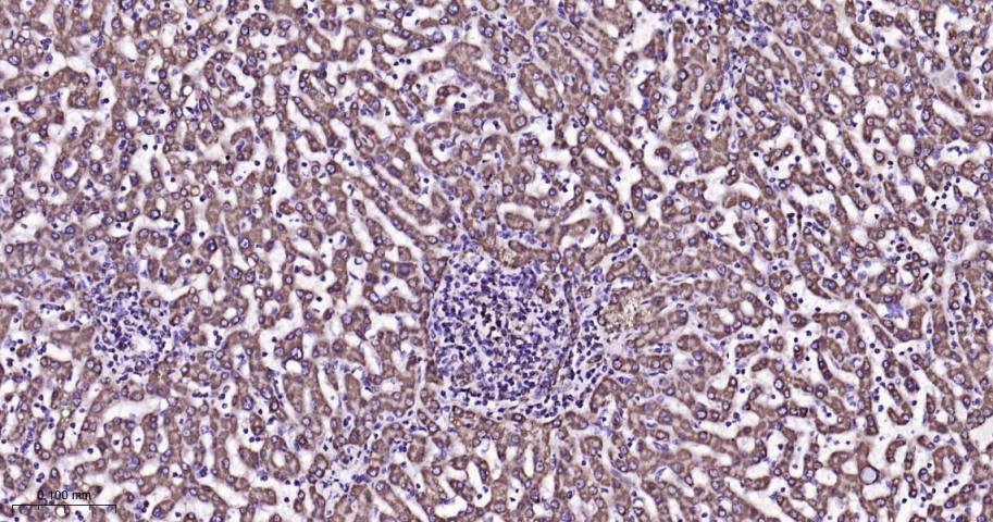 等电压依赖性阴离子通道（内参）重组兔单抗