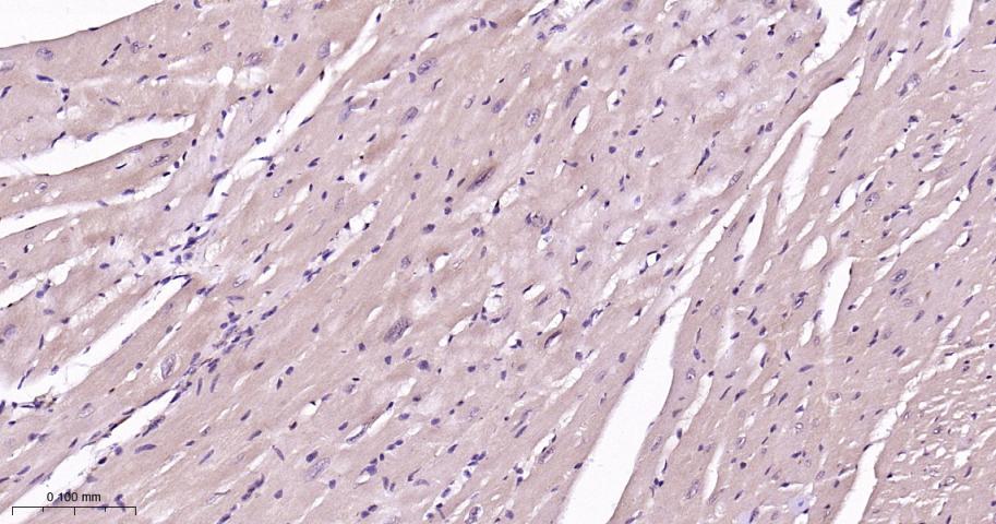 p38 MAPK重组兔单抗