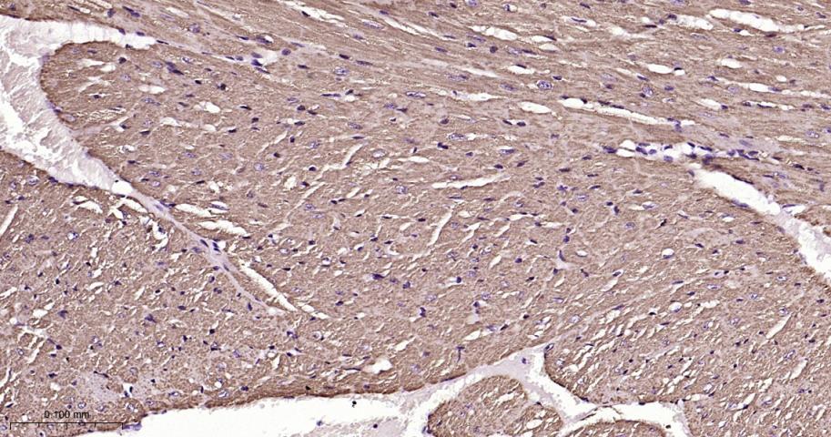 等电压依赖性阴离子通道（内参）重组兔单抗