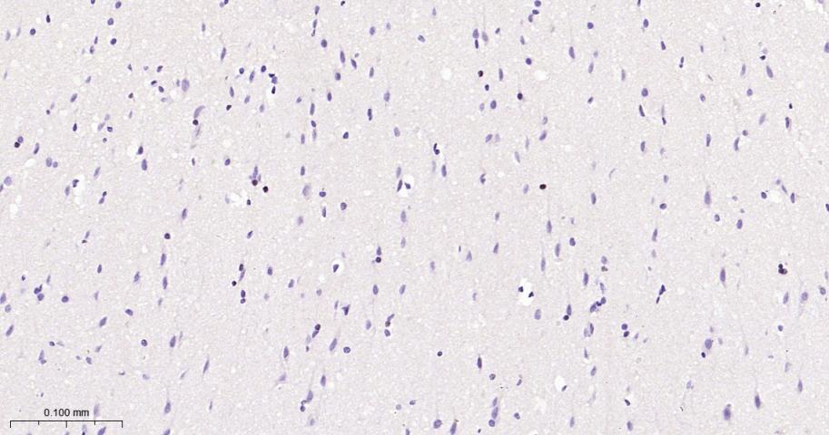 转录因子SOX10重组兔单抗