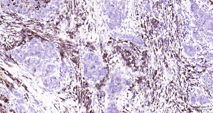 环氧合酶2/前列腺素内过氧化物合成酶2抗体-bs-0732R
