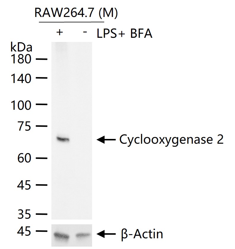 环氧合酶2/前列腺素内过氧化物合成酶2抗体-bs-0732R