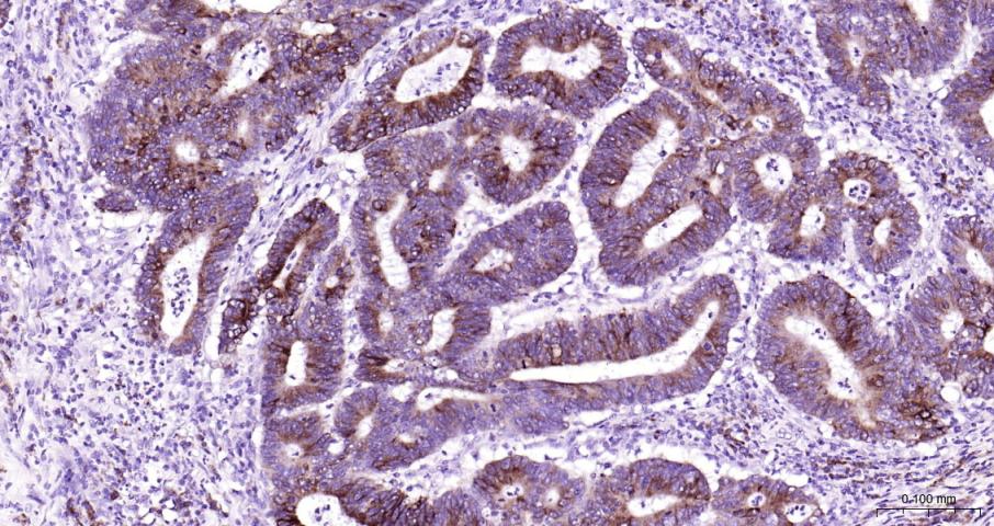 环氧合酶2/前列腺素内过氧化物合成酶2抗体-bs-0732R