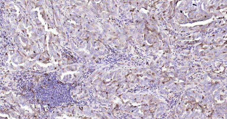 STMN1 Mouse mAb (一抗) - IHC-P,IHC-F,IF | Bioss