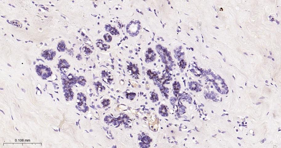 转录因子SOX10重组兔单抗