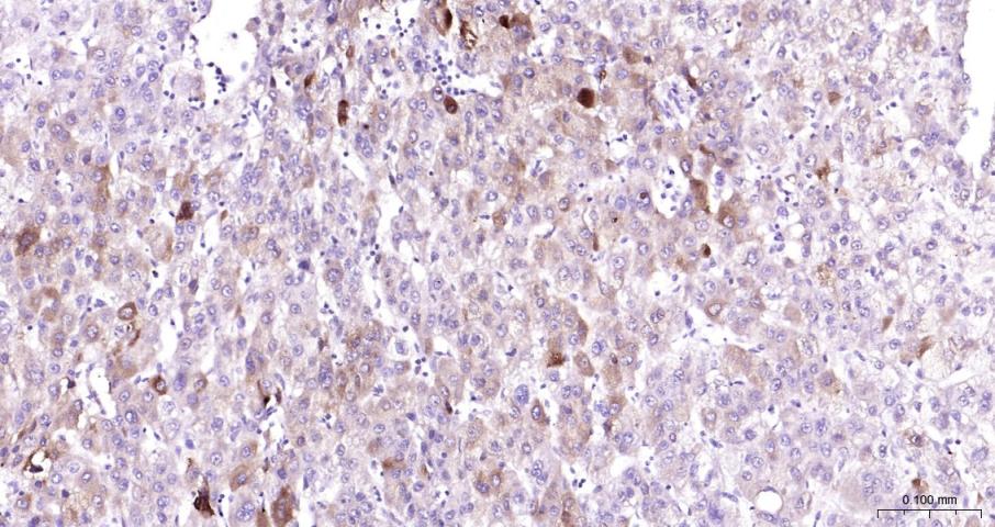 环氧合酶2/前列腺素内过氧化物合成酶2抗体-bs-0732R