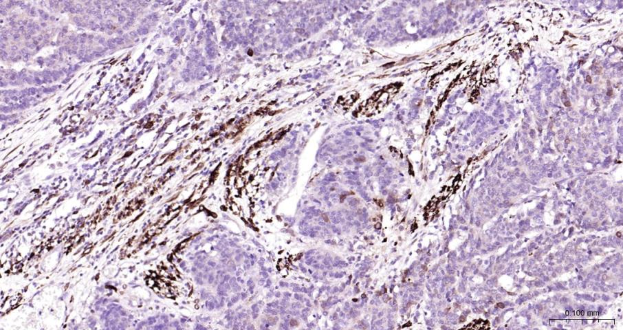 环氧合酶2/前列腺素内过氧化物合成酶2抗体-bs-0732R