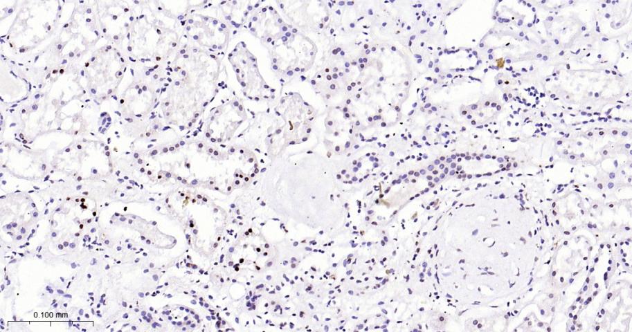 周期蛋白依赖激酶抑制因子1C重组兔单抗