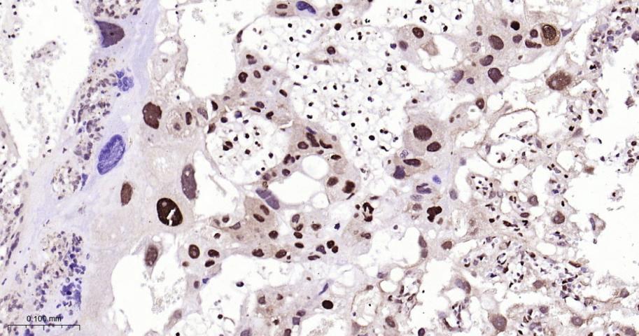 周期蛋白依赖激酶抑制因子1C重组兔单抗