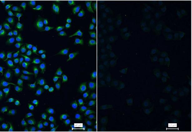 波形蛋白单克隆抗体-bsm-33170M