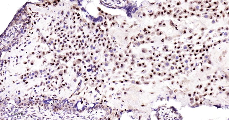 周期蛋白依赖激酶抑制因子1C重组兔单抗