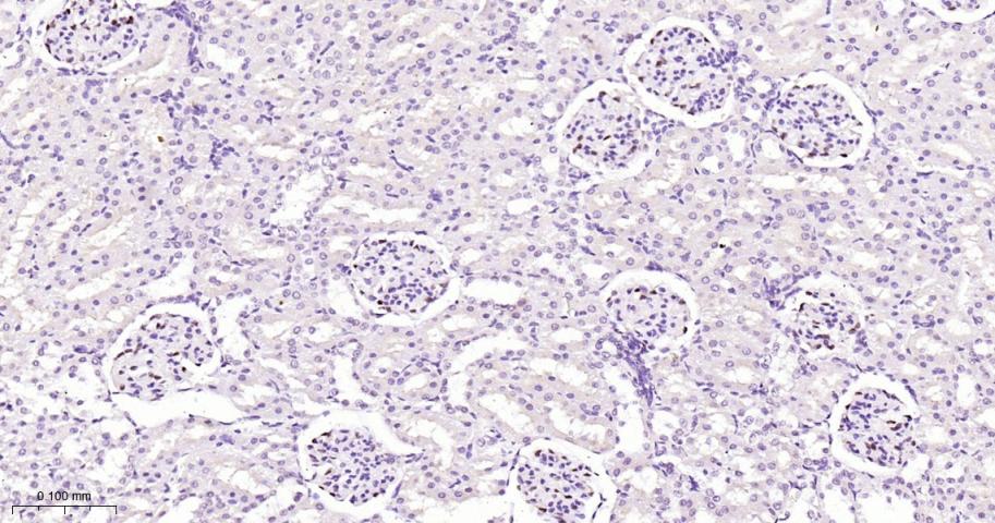 周期蛋白依赖激酶抑制因子1C重组兔单抗