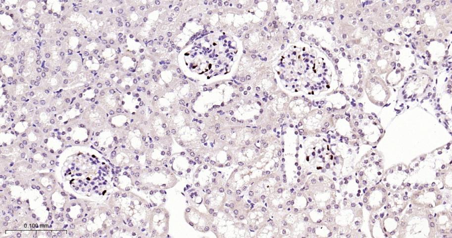 周期蛋白依赖激酶抑制因子1C重组兔单抗