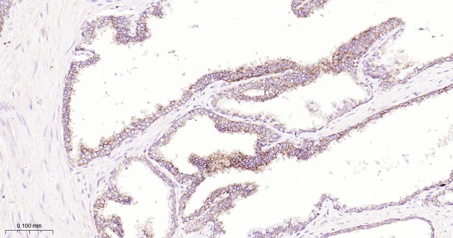 B Raf重组兔单抗