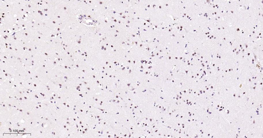 周期蛋白依赖激酶抑制因子1C重组兔单抗