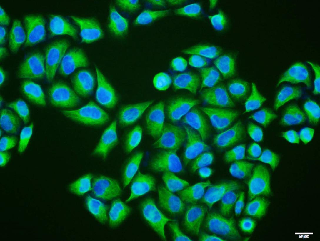 波形蛋白单克隆抗体-bsm-33170M