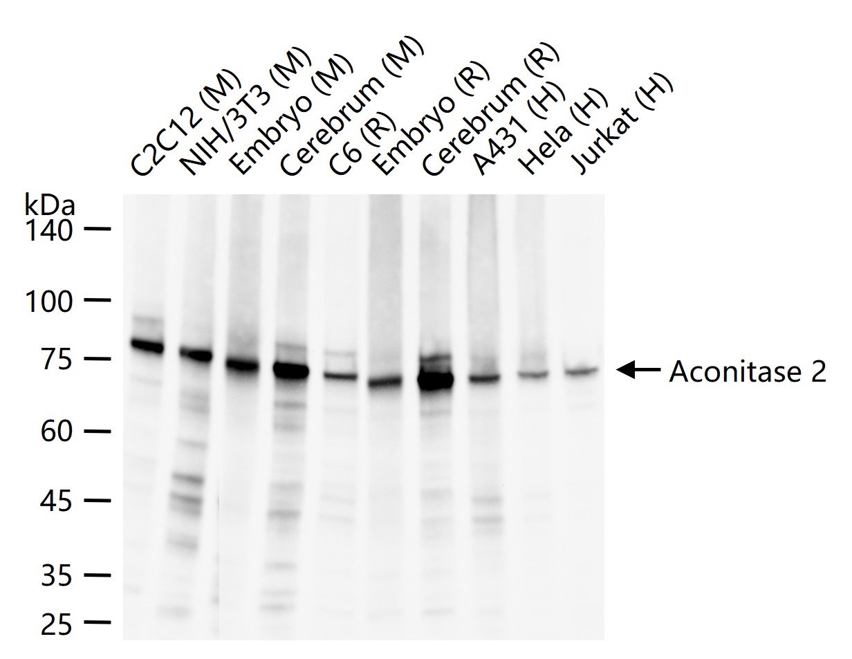铁调节蛋白2重组兔单抗