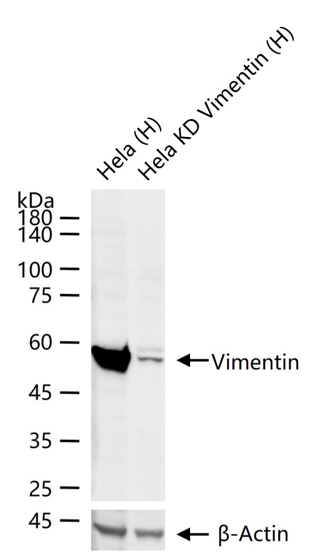波形蛋白抗体-bs-23063R