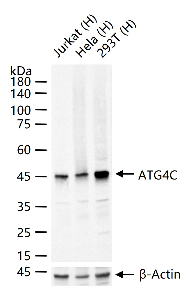 ATG4C Recombinant Rabbit mAb (一抗) - WB,IHC-P,IHC-F,IF,ICC/IF | Bioss