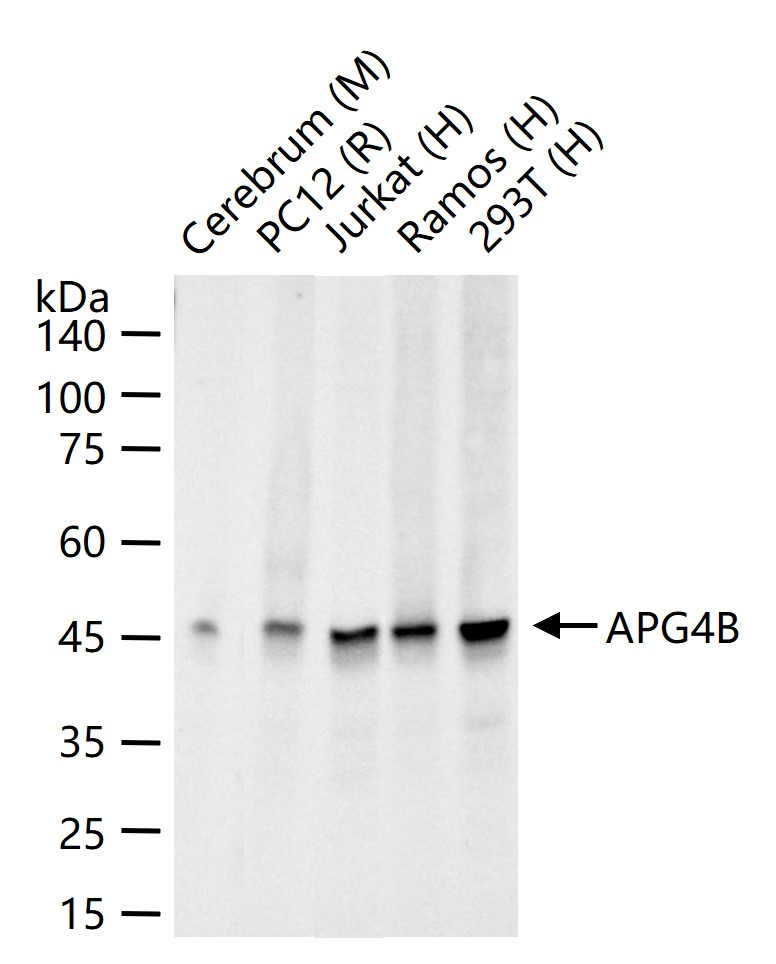 自噬相关蛋白4B重组兔单抗-bsm-61514R