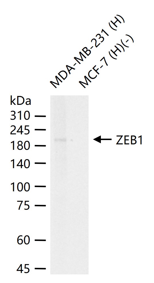 负调控因子白细胞介素2重组兔单抗