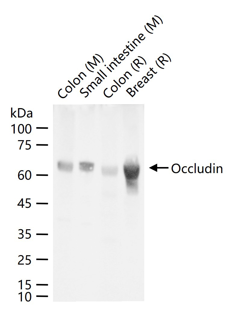 紧密连接蛋白重组兔单抗