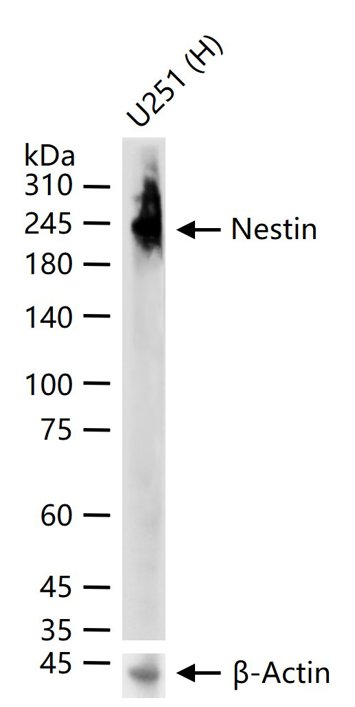 巢蛋白/神经上皮干细胞蛋白重组兔单克隆抗体