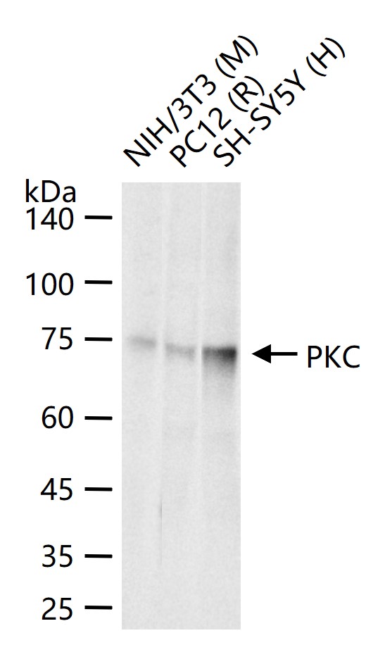 蛋白激酶C重组兔单抗