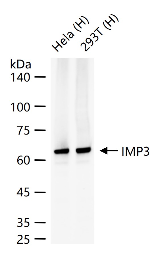 胰岛素样生长因子2mRNA结合蛋白3重组兔单抗