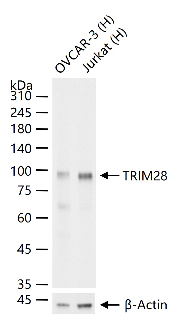 转录中介因子Tif1β重组兔单抗