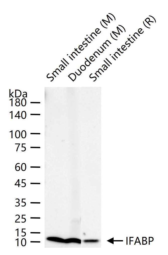 肠型脂肪酸结合蛋白重组兔单抗
