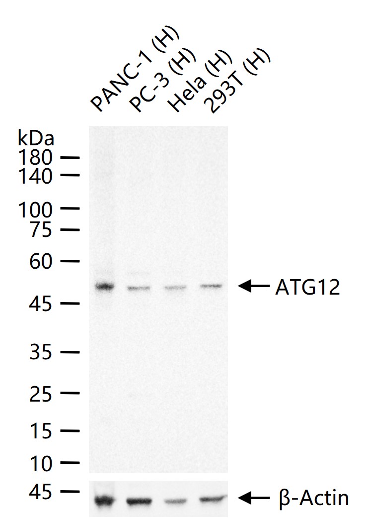 自噬相关蛋白12重组兔单抗-bsm-61199R