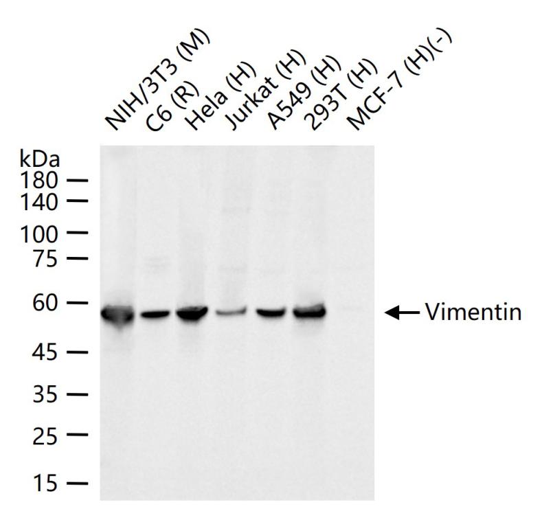 波形蛋白抗体-bs-8533R
