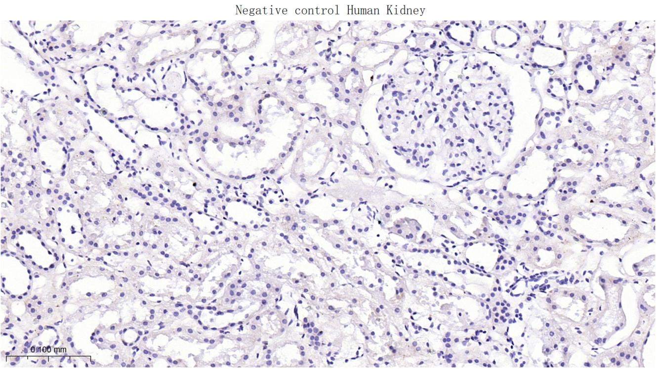 尾型同源盒转录因子2重组兔单抗